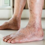 Skin changes and discoloration symptoms background image