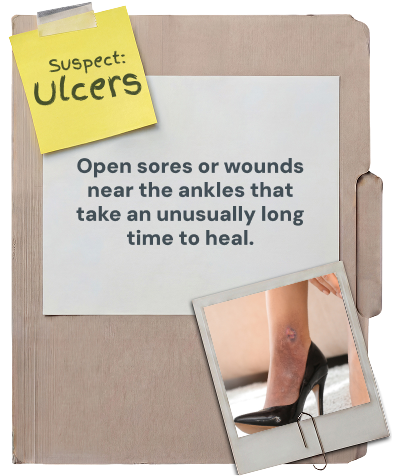 Ulcers: open sores or wounds near the ankles that take an unusually long time to heal.